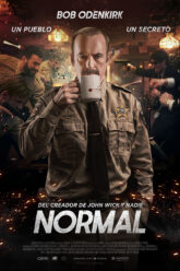 Normal